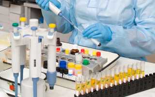 Подробная расшифровка результатов анализа секрета простаты