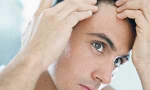 Эффективные рецепты против выпадения волос