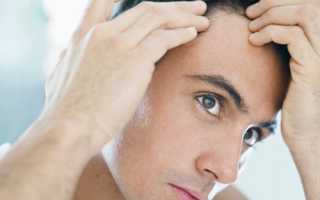 Эффективные рецепты против выпадения волос