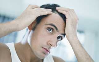 Облысение у мужчин: лечение народными проверенными средствами