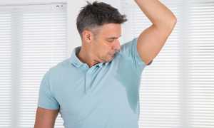 Лечение гипергидроза подмышек народными средствами