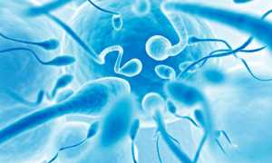 Проблема агглютинации спермиев и способы её устранения