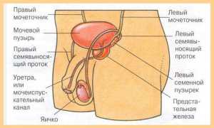 Как и зачем проводится удаление мочевого пузыря у мужчин?