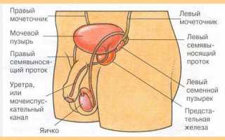 Как и зачем проводится удаление мочевого пузыря у мужчин?