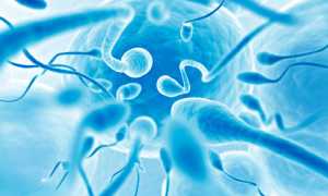 Что такое застой спермы?