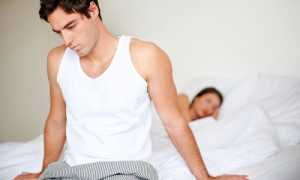 Как проводят лечение варикоцеле 3 степени?