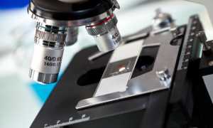 Анализ состава спермы: спермиофаги и другие показатели