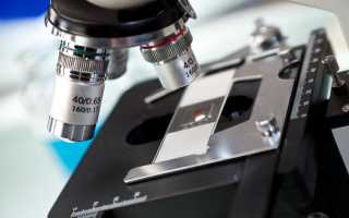 Анализ состава спермы: спермиофаги и другие показатели