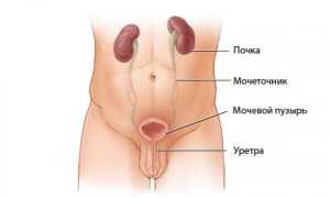 Причины воспаления и основные методы лечения мочевого пузыря у мужчин