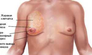 Почему у мужчины увеличены молочные железы?