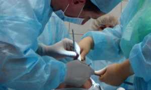 Кастрация мужчин: что это такое и зачем она проводится?