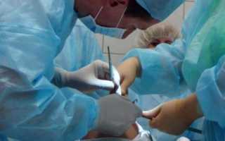 Кастрация мужчин: что это такое и зачем она проводится?