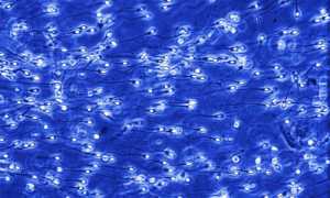 Отчего у мужчин бывает сперма комочками?