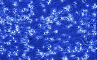 Отчего у мужчин бывает сперма комочками?