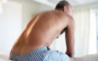 Симптомами каких заболеваний могут являться прыщи на пенисе