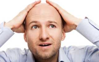 Какое средство лучше использовать от облысения для мужчин?