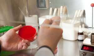 Как и зачем проводится бактериологический посев спермы?