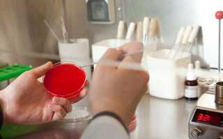 Как и зачем проводится бактериологический посев спермы?