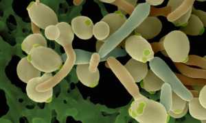 Способы лечения хронического кандидоза у мужчин