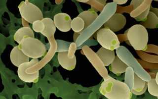 Способы лечения хронического кандидоза у мужчин