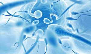 Диагностика и причины 3 степени олигозооспермии