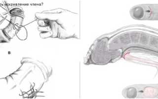 Как можно выровнять член?