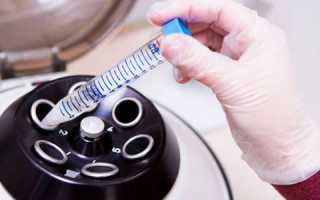 Суть и расшифровка мар теста