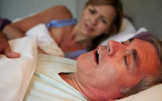 Применение внутриротового устройства от храпа