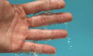 Способы лечения потливости ладоней