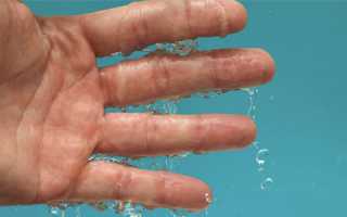 Способы лечения потливости ладоней