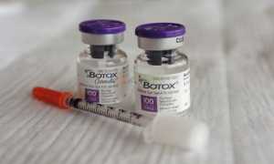 Особенности лечения гипергидроза подмышек ботоксом