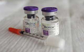 Особенности лечения гипергидроза подмышек ботоксом