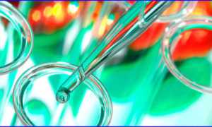 Какие анализы у мужчин сдаются на наличие инфекции в половых органах