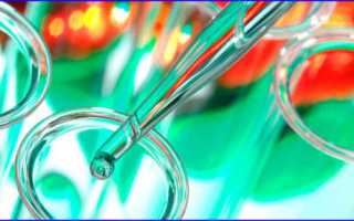 Какие анализы у мужчин сдаются на наличие инфекции в половых органах