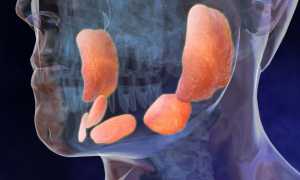 Клиническая картина и осложнения эпидемического паротита