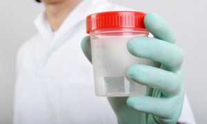 Значение и расшифровка развернутой спермограммы