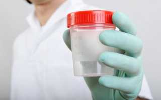 Значение и расшифровка развернутой спермограммы