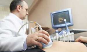 Особенности проведения УЗИ органов малого таза у мужчин