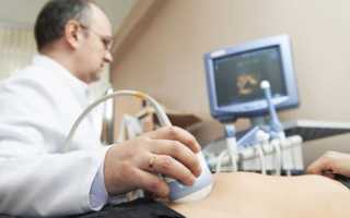 Особенности проведения УЗИ органов малого таза у мужчин