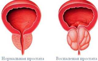 «Простата Форте Мен’с Формула»: все о препарате