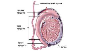Киста придатка правого или левого яичка у мужчин