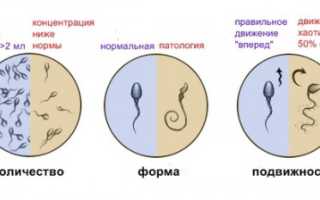 Что такое астеноолигозооспермия?