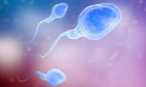 Что такое астенозооспермия?