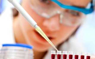 Когда назначается и что показывает ПСА общий?