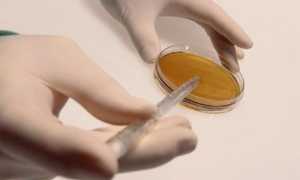 О чем говорит агглютинация в спермограмме