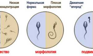 Если нужно узнать качество семени, как можно проверить сперму?