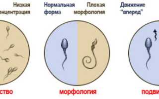 Если нужно узнать качество семени, как можно проверить сперму?
