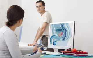 Если у мужчины моча коричневого цвета — что делать?