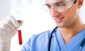 Норма уровня сахара в крови у мужчин