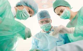 Лечение храпа с помощью хирургической операции